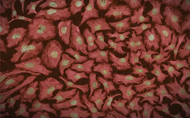 October 4, 1951: Henrietta Lacks dies at 31, her cells advance global medicine